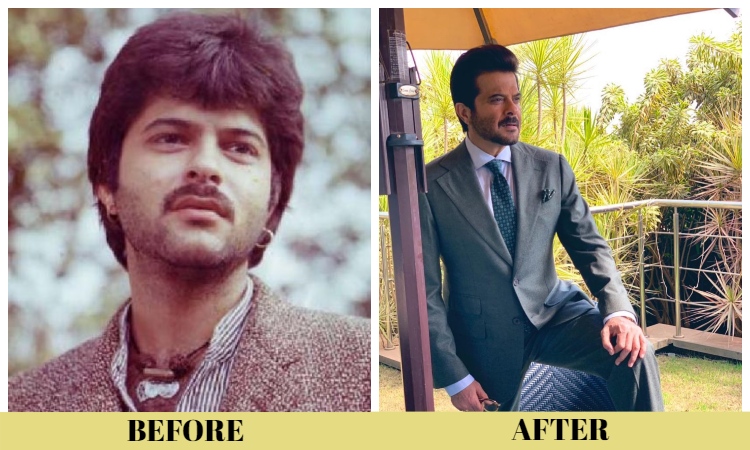 anil kapoor before and after
